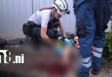 Foto: Adolescente de 15 años se provoca heridas en un brazo en plena vía pública en Estelí/TN8