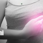 Nicaragua lanza campaña nacional para detectar el cáncer de mama y próstata Foto: Nicaragua lanza campaña nacional para detectar el cáncer de mama y próstata /TN8