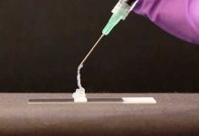 ¡Contra el cáncer! Científicos rusos desarrollan un gel inteligente para atacar tumores Foto: Rusia apuesta por un gel contra los tumores/Cortesía