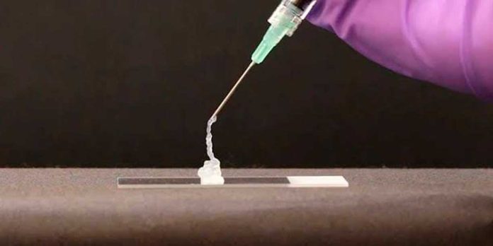 Foto: Rusia apuesta por un gel contra los tumores/Cortesía Foto: Rusia apuesta por un gel contra los tumores/Cortesía