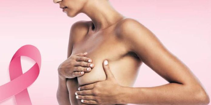 Foto: Cáncer de mama: informarse también salva vidas / Cortes