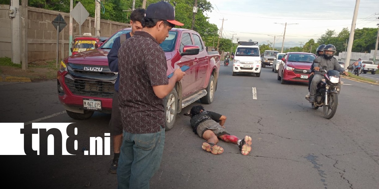 Foto: Fuerte choque en la entrada a Xiloá / TN8