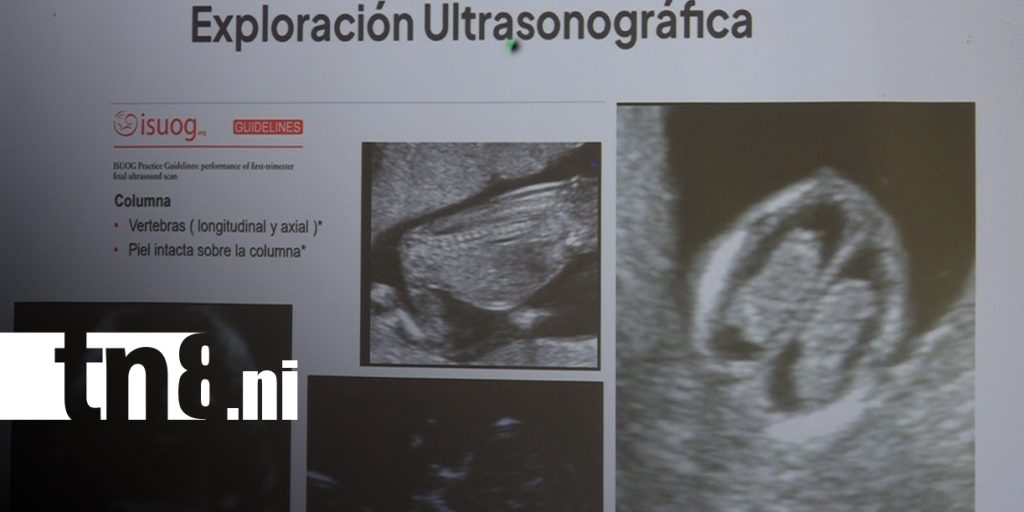 Foto: MINSA aborda espina bífida e hidrocefalia en Madriz/TN8
